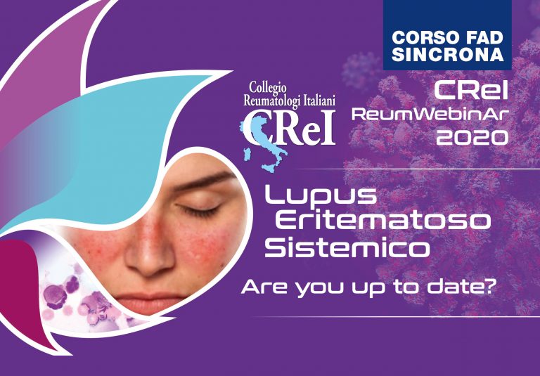 Corso FAD sincrona: Lupus Eritematoso Sistemico – Are you up to date?