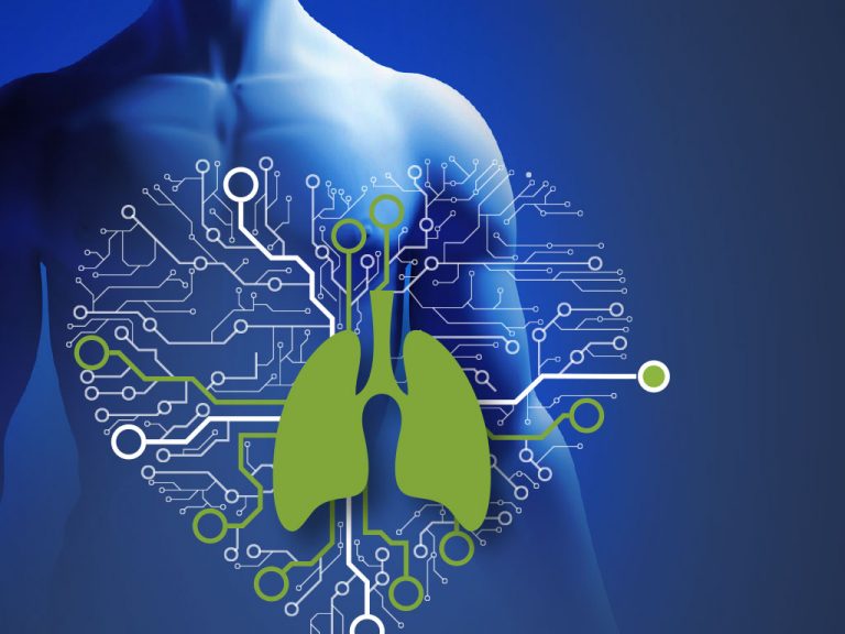 SHARING FOR CHOOSING: QUALE DOAC PER QUALE PAZIENTE