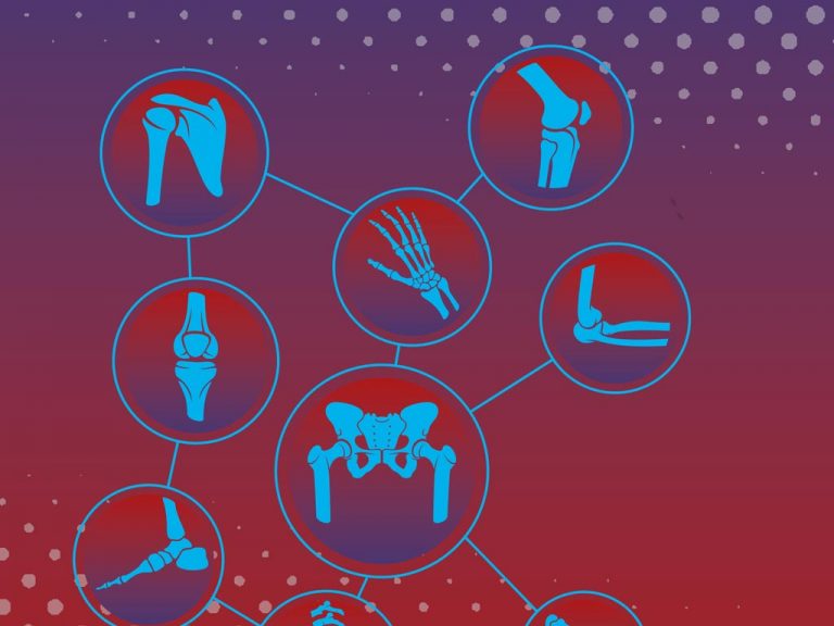 REUWEBINAR – Gli appuntamenti della Reumatologia