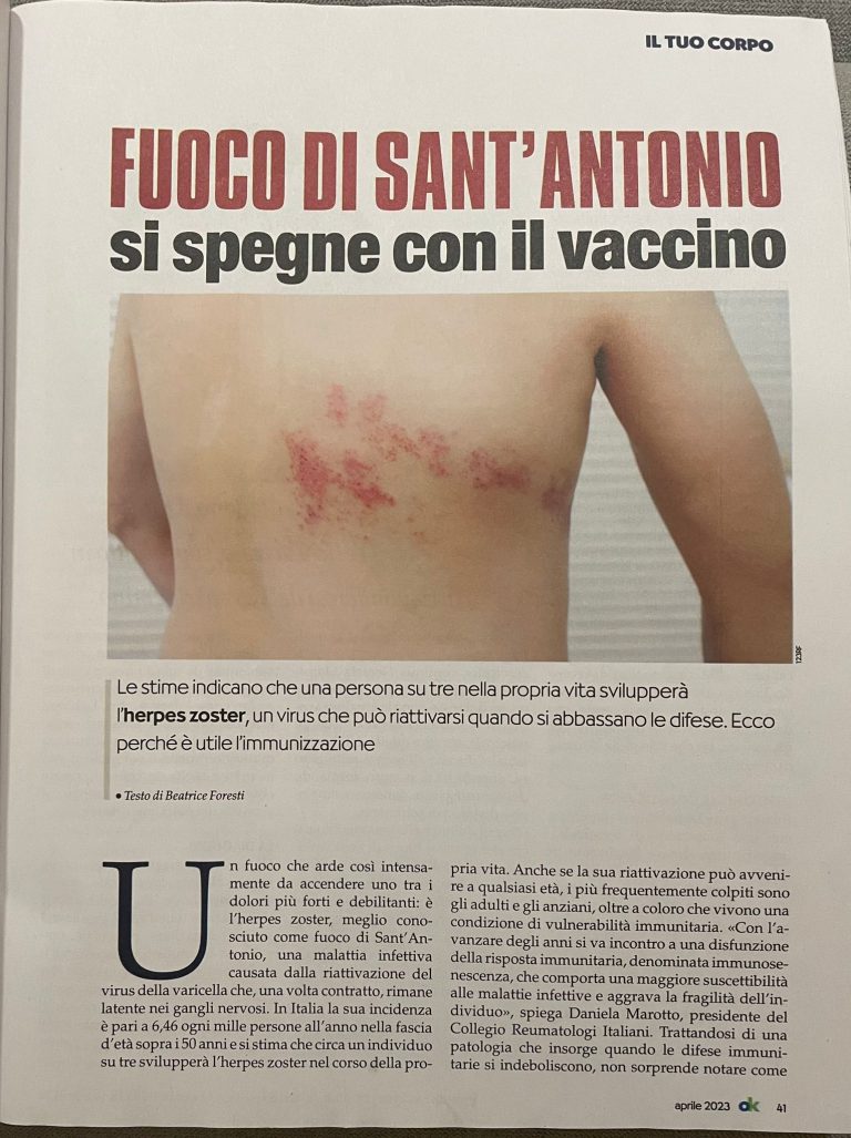 Il CReI su OK Salute e Benessere: si parla di Fuoco di Sant’Antonio